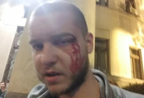 Žikica Stevanović nakon napada (foto: privatna arhiva, izvor: UNS)